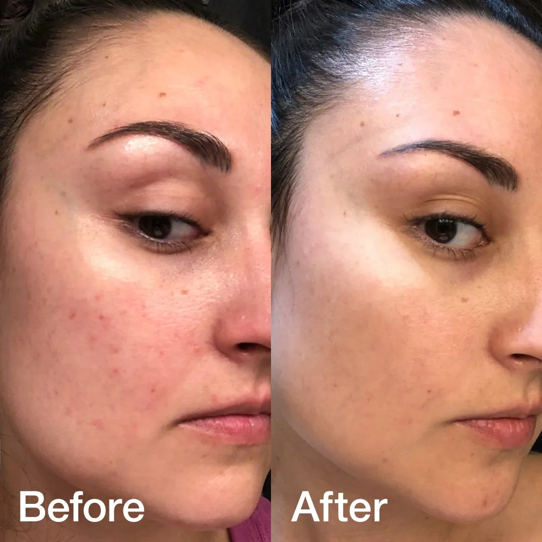 [Triple Collagen] [20% OFF] Glass Glow Duo 3.0